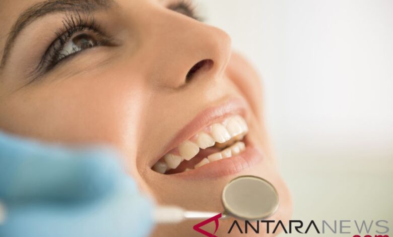 Apa itu perawatan veneer gigi? Ini adalah adalah penjelasan juga khasiat lengkapnya